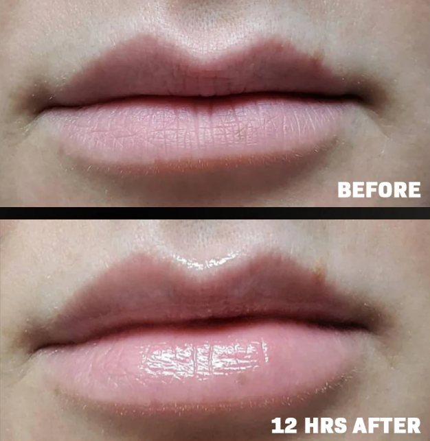 Youthful Lip Replenisher